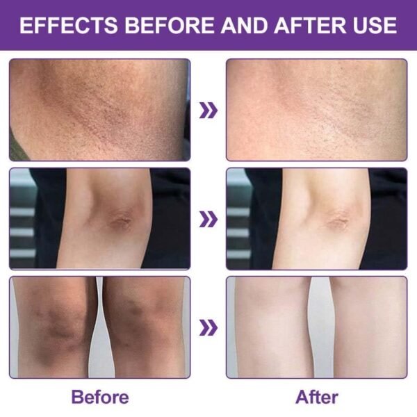 Crema Aclaradora Para Piel Manchas En Cara Axilas Cuello Entrepierna - Image 2